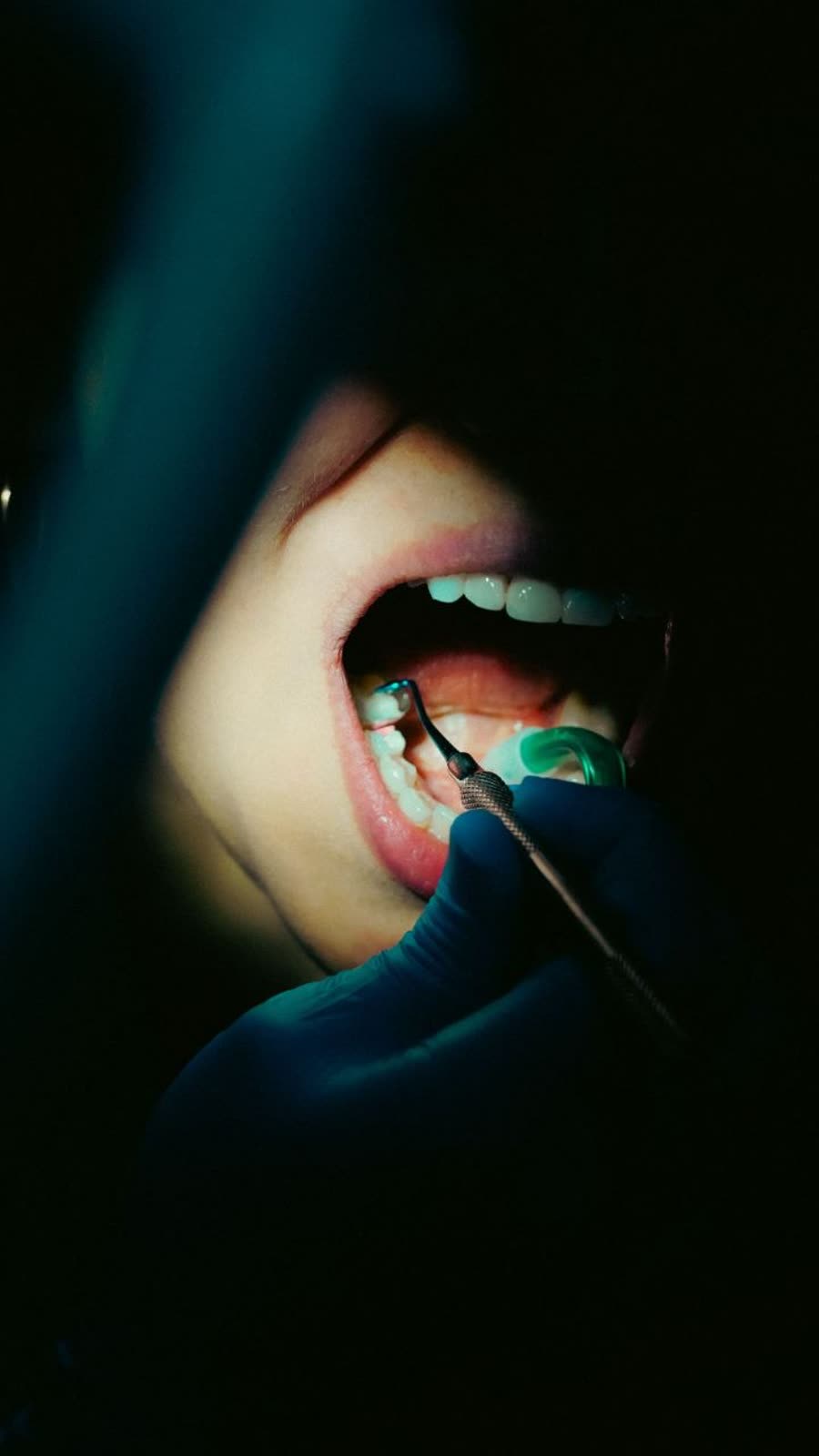 Procedimiento dental en primer plano con guantes